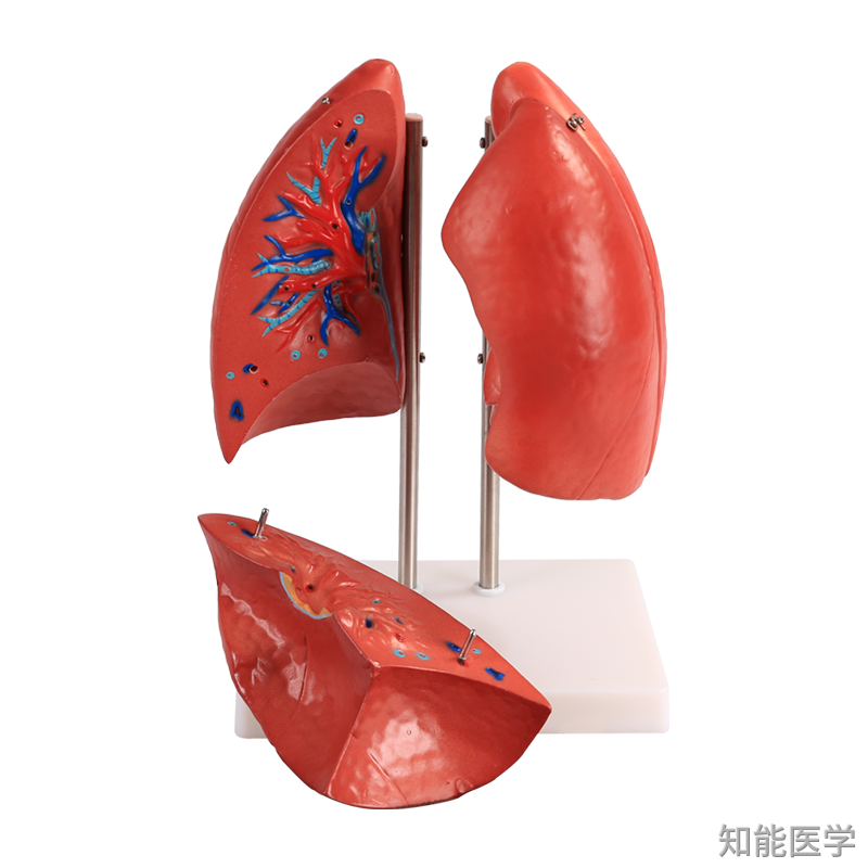 肺解剖模型
